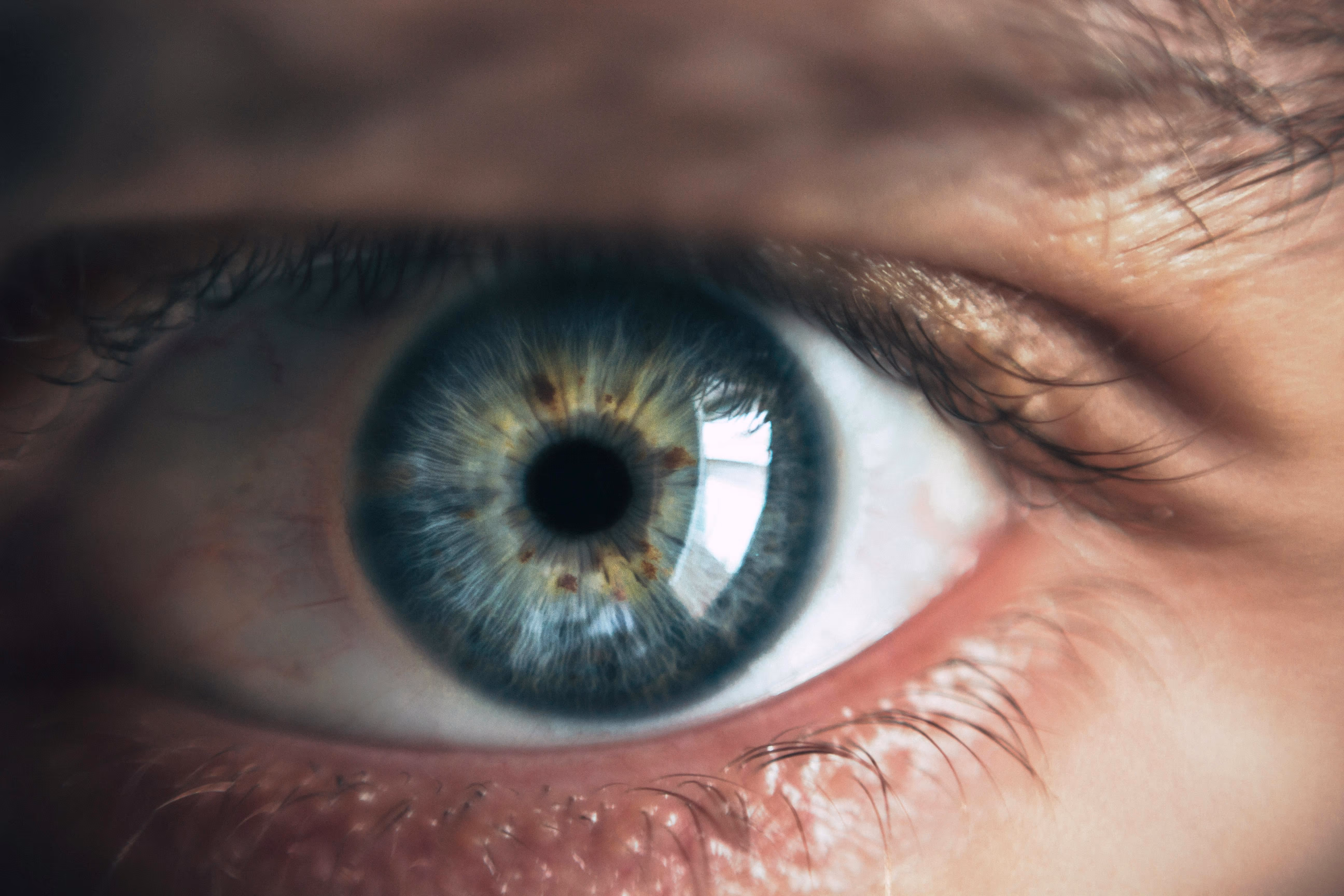 Cataractă