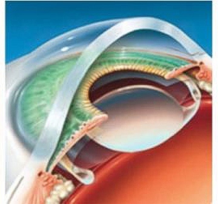 Ama Optimex - Clinica de oftalmologie